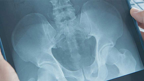 Radiologic Technology program